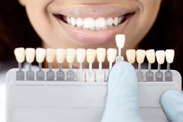 How Veneers Can Improve Teeth Appearance